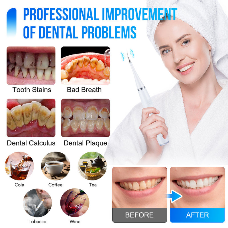 Load image into Gallery viewer, Cross-border 5-speed high-frequency vibration tooth cleaner USB electric toothbrush tooth cleaner to remove stains and calculus set tooth cleaner
